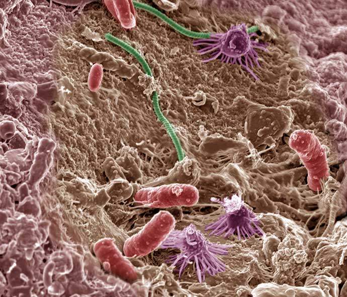 Close-up of microbes under a microscope